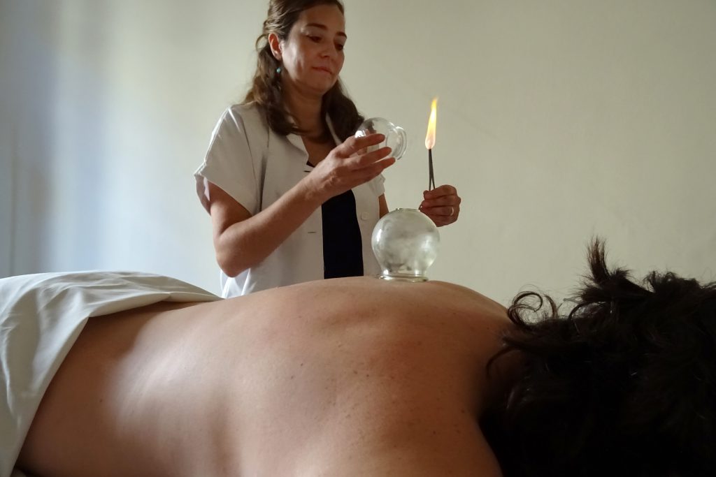 ventosas. cristina escobedo. terapeuta. acupuntura. medicina tradicional china