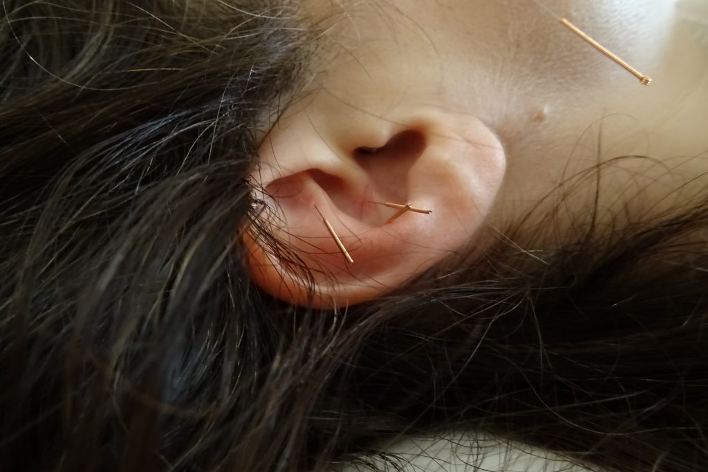 auriculoterapia. cristina escobedo. terapeuta. acupuntura. medicina tradicional china
